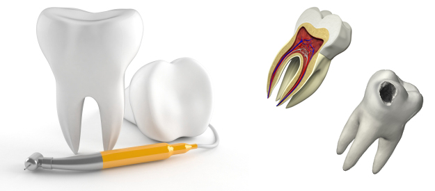 Animated Tooth Illustrations